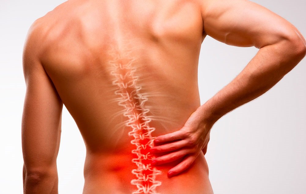 Tratamiento de hernia de disco lumbar y dolor de espalda en NOVOCEN