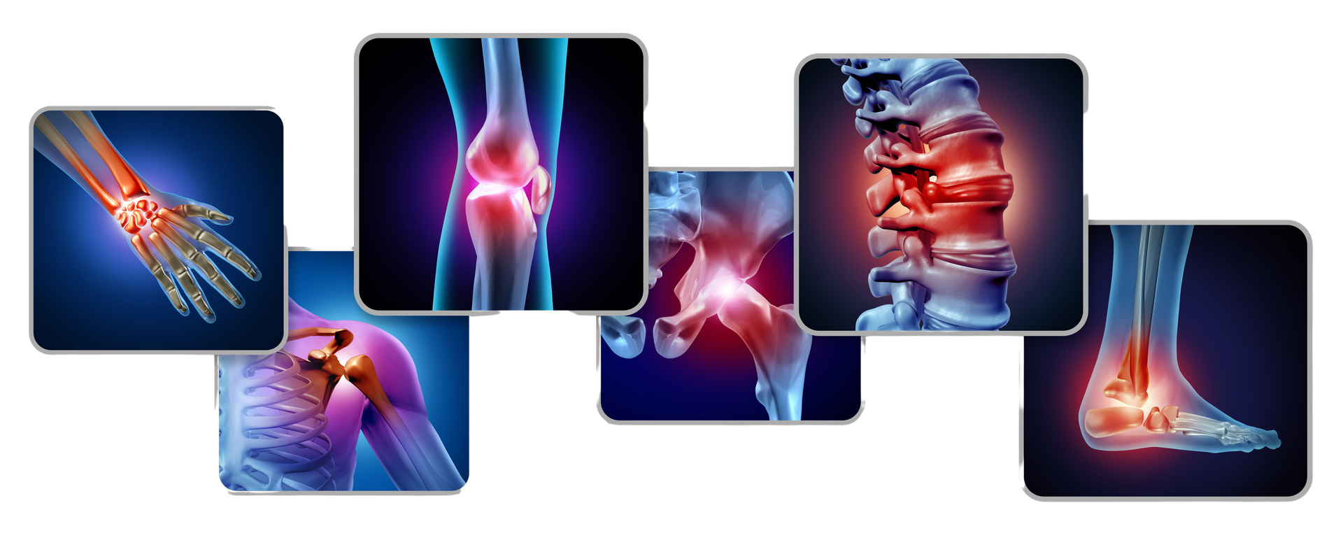 Padecimientos articulares tratados en NOVOCEN: manos, rodilla, hombro, cadera, columna, tobillo